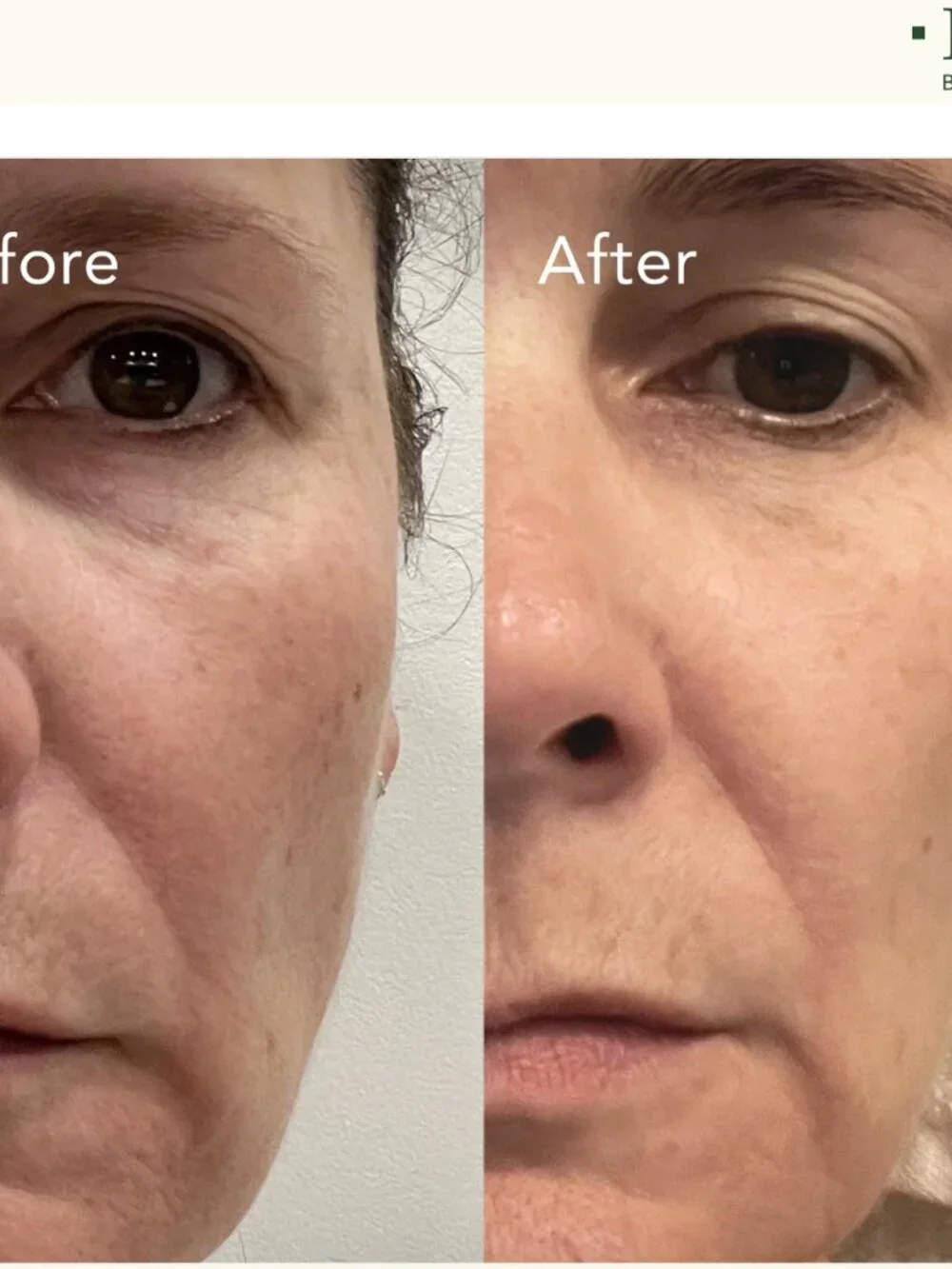 🌸 KAT BURKI Rosehip Intense Recovery Eye Serum Vitamin C, Retinol, Niacinamide